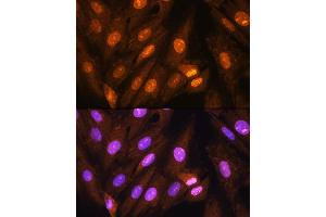Immunofluorescence analysis of H9C2 cells using PP1 beta Rabbit pAb (ABIN6128486, ABIN6146055, ABIN6146057 and ABIN6217560) at dilution of 1:100. (PPP1CB antibody  (AA 1-327))