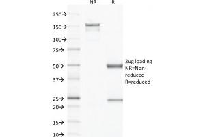 SDS-PAGE Analysis Purified VEGF Mouse Monoclonal Antibody (VG1). (VEGFA antibody)