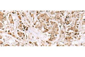 INSM1 antibody