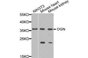 Western blot analysis of extracts of various cell lines, using OGN antibody (ABIN5975049) at 1/1000 dilution. (OGN antibody)