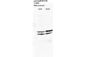 Western blot of anti-hnRNP-F/H on HeLa cell extract (HNRNPL antibody)