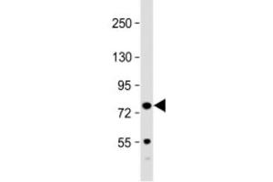 Western blot testing of mouse spleen lysate with Kindlin-3 antibody at 1:2000. (FERMT3 antibody  (AA 117-151))