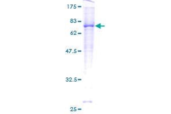 ACVRL1 Protein (AA 22-503) (GST tag)