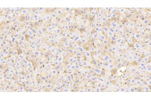 Detection of HBb in Mouse Liver Tissue using Polyclonal Antibody to Hemoglobin Beta (HBb)