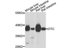 Western blot analysis of extracts of various cell lines, using OTC antibody (ABIN6003566) at 1/1000 dilution. (OTC antibody)