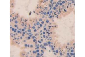 Figure. (RNF39 antibody  (AA 1-420))