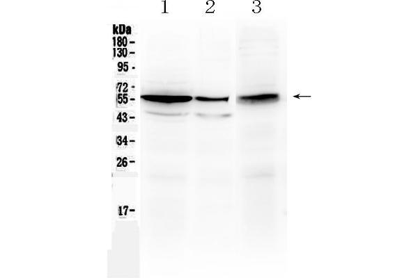 ALDH1A3 抗体  (AA 37-154)