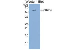 Detection of Recombinant CTSK, Canine using Polyclonal Antibody to Cathepsin K (CTSK) (Cathepsin K antibody  (AA 71-319))