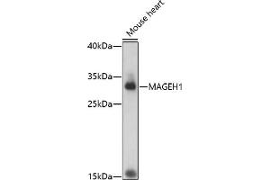 Western blot analysis of extracts of mouse heart, using M antibody (ABIN7268457) at 1:1000 dilution. (MAGEH1 antibody  (AA 10-90))