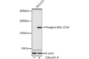 Western blot analysis of extracts of NIH/3T3 cells, using Phospho-IRE1-S724 antibody  at 1:500 dilution. (ERN1 antibody  (pSer724))