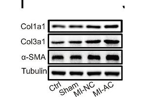 Activated CD4+ T cells-derived exosomes deteriorate cardiac function post-MI in mouse. (COL3A1 antibody  (AA 1217-1466))