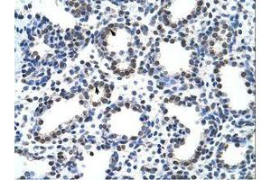 Image no. 1 for anti-Cysteinyl-tRNA Synthetase (CARS) (AA 31-80) antibody (ABIN6736227) (CARS antibody  (AA 31-80))
