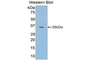 Western Blotting (WB) image for anti-Lipolysis Stimulated Lipoprotein Receptor (LSR) (AA 335-589) antibody (ABIN5662021) (LSR antibody  (AA 335-589))