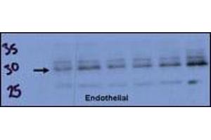 Endothelial cell lysate transferred to membrane was incubated with primary antibody at a 1:500 dilution in 2% BSA in TBST at 4 deg C overnight. (RCAN1 antibody  (AA 75-104))