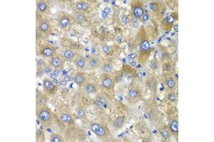 Immunohistochemistry of paraffin-embedded human liver injury using TLK2 antibody at dilution of 1:100 (x40 lens). (TLK2 antibody)