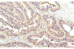 Immunohistochemistry of paraffin-embedded Human colon tissue using STAT1 Monoclonal Antibody at dilution of 1:200. (STAT1 antibody)