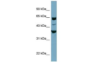 WB Suggested Anti-SEC22C Antibody Titration:  0. (SEC22C antibody  (Middle Region))