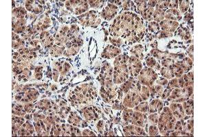 Image no. 1 for anti-Parvin, alpha (PARVA) antibody (ABIN1496443) (Parvin alpha antibody)