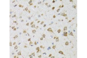 Immunohistochemistry of paraffin-embedded Rat brain using PI3 Polyclonal Antibody at dilution of 1:100 (40x lens). (PI3 antibody)