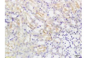 Formalin-fixed and paraffin embedded rat kidney tissue labeled with Anti-SLC16A3 Polyclonal Antibody, Unconjugated (ABIN749303) at 1:200 followed by conjugation to the secondary antibody and DAB staining (SLC16A3 antibody  (AA 401-465))