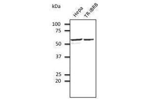 Anti-EEAI Ab at 1/500 dilution, Rabbit polyclonal to goat lµg (HRP) at 1/10,000 dilution, (PDIA3 antibody  (C-Term))