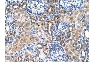 SLC46A3 antibody was used for immunohistochemistry at a concentration of 4-8 ug/ml to stain Epithelial cells of renal tubule (arrows) in Human Kidney. (SLC46A3 antibody  (N-Term))