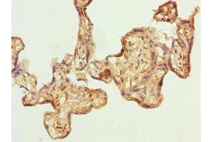 GPSM3 antibody  (AA 1-160)