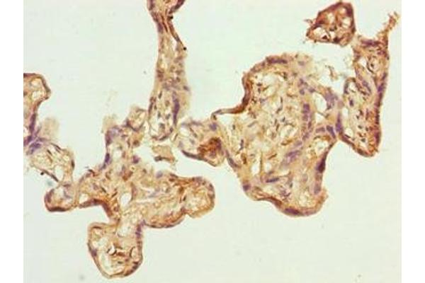 GPSM3 Antikörper  (AA 1-160)