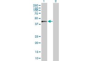 Western Blot analysis of ZNF584 expression in transfected 293T cell line by ZNF584 MaxPab polyclonal antibody. (ZNF584 antibody  (AA 1-421))