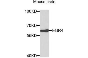 Western blot analysis of extracts of Mouse brain cells, using EGR4 antibody. (EGR4 antibody)