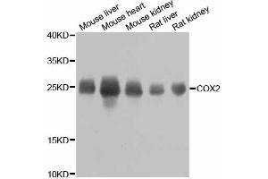 Western blot analysis of extracts of various cell lines, using MT-CO2 antibody (ABIN6294175) at 1:800 dilution.