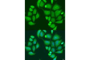Immunofluorescence analysis of U2OS cells using CAPN2 antibody (ABIN2736399) at dilution of 1:100. (Calpain 2 antibody)