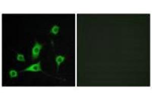 Immunofluorescence analysis of LOVO cells, using CRBP III antibody. (Retinol Binding Protein 5 antibody)