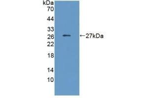 Detection of Recombinant CRP, Human using Monoclonal Antibody to C Reactive Protein (CRP) (CRP antibody  (AA 17-224))