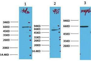 Western Blotting (WB) image for anti-Nuclear Factor-kB p65 (NFkBP65) antibody (ABIN3178606) (NF-kB p65 antibody)