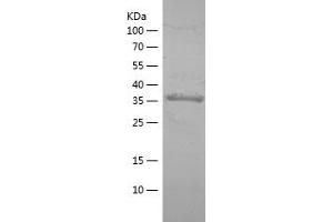 Western Blotting (WB) image for Arylsulfatase A (ARSA) (AA 367-485) protein (His-IF2DI Tag) (ABIN7282025) (Arylsulfatase A Protein (ARSA) (AA 367-485) (His-IF2DI Tag))