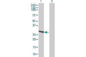 Western Blot analysis of METTL9 expression in transfected 293T cell line ( H00051108-T01 ) by METTL9 MaxPab polyclonal antibody. (METTL9 antibody  (AA 1-283))