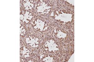 Immunohistochemical analysis of (ABIN391830 and ABIN2841673) on paraffin-embedded Human colon tissue. (HSP70 1A antibody  (AA 19-48))