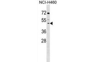 Western Blotting (WB) image for anti-Decapping Enzyme, Scavenger (DCPS) antibody (ABIN2999210) (DCPS antibody)