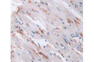 Used in DAB staining on fromalin fixed paraffin- embedded heart tissue (RHAG antibody  (AA 251-450))