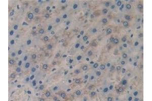 Detection of CFLAR in Rat Liver Tissue using Polyclonal Antibody to CASP8 And FADD Like Apoptosis Regulator (CFLAR) (FLIP antibody  (AA 43-281))