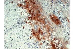 Immunohistochemistry staining of human pituitary gland (frozen sections) with anti-human beta Endorphin (B31. (beta Endorphin antibody)