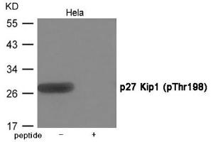Western blot analysis of extracts from Hela cells using p27 Kip1 (Phospho-Thr198) Antibody. (CDKN1B antibody  (pThr198))