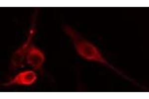 ABIN6275662 staining 293 cells by IF/ICC. (UBAC1 antibody  (Internal Region))
