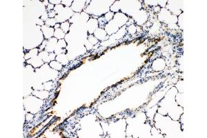 IHC-P: FGFR3 antibody testing of rat lung tissue (FGFR3 antibody  (N-Term))