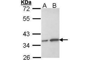 WB Image Sample (30 ug of whole cell lysate) A: Hela B: Hep G2 , 12% SDS PAGE antibody diluted at 1:1000 (OTUB1 antibody  (Center))