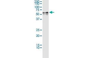 Immunoprecipitation (IP) image for HNF4A (Human) IP-WB Antibody Pair (ABIN2752019)