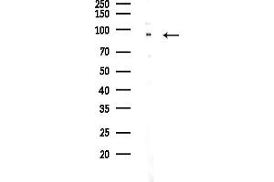 Western blot analysis of lysates from COLO205 cells(UV,30 min treatment), using TRPC4AP Antibody at 1/1000 dilution.