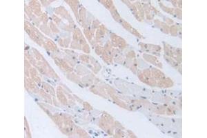 Figure. (BMP5 antibody  (AA 315-452))