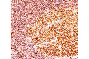 IHC staining of tonsil tissue with MALT1 antibody (MT1/410). (MALT1 antibody  (AA 701-808))